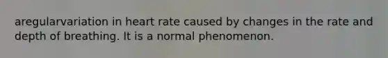 aregularvariation in heart rate caused by changes in the rate and depth of breathing. It is a normal phenomenon.