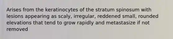 Arises from the keratinocytes of the stratum spinosum with lesions appearing as scaly, irregular, reddened small, rounded elevations that tend to grow rapidly and metastasize if not removed