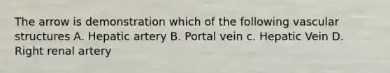 The arrow is demonstration which of the following vascular structures A. Hepatic artery B. Portal vein c. Hepatic Vein D. Right renal artery