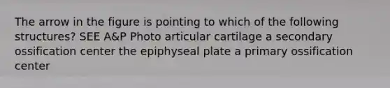 The arrow in the figure is pointing to which of the following structures? SEE A&P Photo articular cartilage a secondary ossification center the epiphyseal plate a primary ossification center