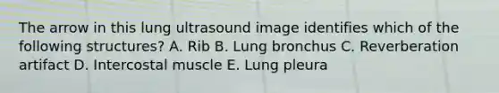 The arrow in this lung ultrasound image identifies which of the following structures? A. Rib B. Lung bronchus C. Reverberation artifact D. Intercostal muscle E. Lung pleura