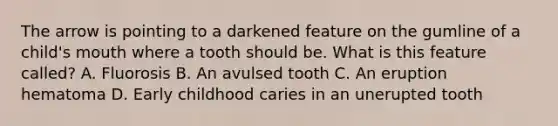 The arrow is pointing to a darkened feature on the gumline of a child's mouth where a tooth should be. What is this feature called? A. Fluorosis B. An avulsed tooth C. An eruption hematoma D. Early childhood caries in an unerupted tooth