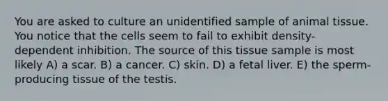 You are asked to culture an unidentified sample of animal tissue. You notice that the cells seem to fail to exhibit density-dependent inhibition. The source of this tissue sample is most likely A) a scar. B) a cancer. C) skin. D) a fetal liver. E) the sperm-producing tissue of the testis.