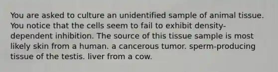 You are asked to culture an unidentified sample of animal tissue. You notice that the cells seem to fail to exhibit density-dependent inhibition. The source of this tissue sample is most likely skin from a human. a cancerous tumor. sperm-producing tissue of the testis. liver from a cow.