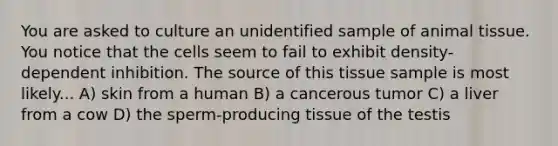 You are asked to culture an unidentified sample of animal tissue. You notice that the cells seem to fail to exhibit density-dependent inhibition. The source of this tissue sample is most likely... A) skin from a human B) a cancerous tumor C) a liver from a cow D) the sperm-producing tissue of the testis