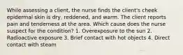 While assessing a client, the nurse finds the client's cheek epidermal skin is dry, reddened, and warm. The client reports pain and tenderness at the area. Which cause does the nurse suspect for the condition? 1. Overexposure to the sun 2. Radioactive exposure 3. Brief contact with hot objects 4. Direct contact with steam