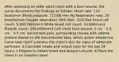 After assessing an older adult client with a burn wound, the nurse documents the findings as follows: Heart rate: 110 beats/min Blood pressure: 112/68 mm Hg Respiratory rate: 20 breaths/min Oxygen saturation: 94% Pain: 3/10 Red blood cell count: 5,000,000/mm3 White blood cell count: 10,000/mm3 Platelet count: 200,000/mm3 Left chest burn wound, 3 cm ´ 2.5 cm ´ 0.5 cm, wound bed pale, surrounding tissues with edema present Based on the documented data, which action should the nurse take next? a.Assess the client's skin for signs of adequate perfusion. b.Calculate intake and output ratio for the last 24 hours. c.Prepare to obtain blood and wound cultures. d.Place the client in an isolation room.