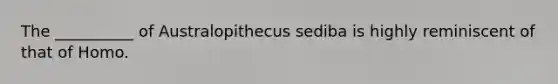 The __________ of Australopithecus sediba is highly reminiscent of that of Homo.