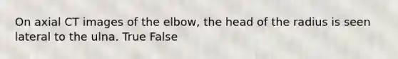 On axial CT images of the elbow, the head of the radius is seen lateral to the ulna. True False