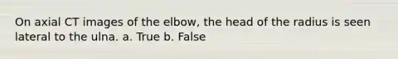 On axial CT images of the elbow, the head of the radius is seen lateral to the ulna. a. True b. False