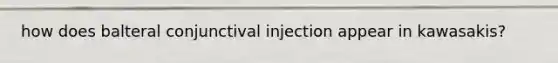 how does balteral conjunctival injection appear in kawasakis?