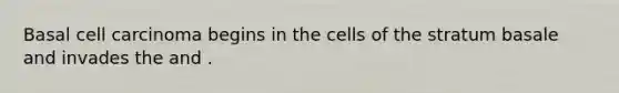 Basal cell carcinoma begins in the cells of the stratum basale and invades the and .