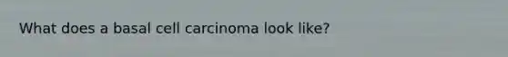 What does a basal cell carcinoma look like?