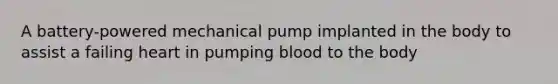 A battery-powered mechanical pump implanted in the body to assist a failing heart in pumping blood to the body