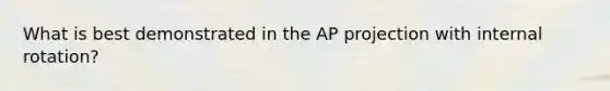 What is best demonstrated in the AP projection with internal rotation?