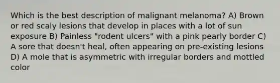 Which is the best description of malignant melanoma? A) Brown or red scaly lesions that develop in places with a lot of sun exposure B) Painless "rodent ulcers" with a pink pearly border C) A sore that doesn't heal, often appearing on pre-existing lesions D) A mole that is asymmetric with irregular borders and mottled color