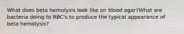 What does beta hemolysis look like on blood agar?What are bacteria doing to RBC's to produce the typical appearance of beta hemolysis?