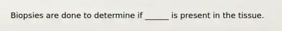 Biopsies are done to determine if ______ is present in the tissue.