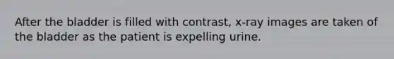 After the bladder is filled with contrast, x-ray images are taken of the bladder as the patient is expelling urine.