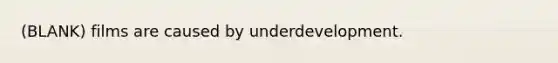 (BLANK) films are caused by underdevelopment.