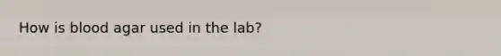 How is blood agar used in the lab?