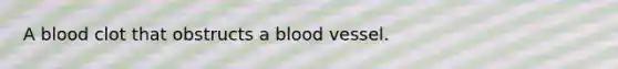 A blood clot that obstructs a blood vessel.