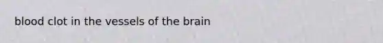 blood clot in the vessels of <a href='https://www.questionai.com/knowledge/kLMtJeqKp6-the-brain' class='anchor-knowledge'>the brain</a>