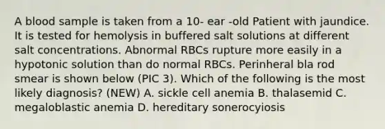 A blood sample is taken from a 10- ear -old Patient with jaundice. It is tested for hemolysis in buffered salt solutions at different salt concentrations. Abnormal RBCs rupture more easily in a hypotonic solution than do normal RBCs. Perinheral bla rod smear is shown below (PIC 3). Which of the following is the most likely diagnosis? (NEW) A. sickle cell anemia B. thalasemid C. megaloblastic anemia D. hereditary sonerocyiosis