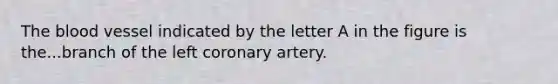 The blood vessel indicated by the letter A in the figure is the...branch of the left coronary artery.