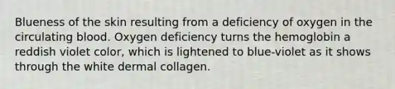 Blueness of the skin resulting from a deficiency of oxygen in the circulating blood. Oxygen deficiency turns the hemoglobin a reddish violet color, which is lightened to blue-violet as it shows through the white dermal collagen.