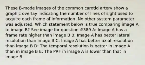 These B-mode images of the common carotid artery show a graphic overlay indicating the number of lines of sight used to acquire each frame of information. No other system parameter was adjusted. Which statement below is true comparing image A to image B? See image for question #389 A: Image A has a frame rate higher than image B B: Image A has better lateral resolution than image B C: Image A has better axial resolution than image B D: The temporal resolution is better in image A than in image B E: The PRF in image A is lower than that in image B