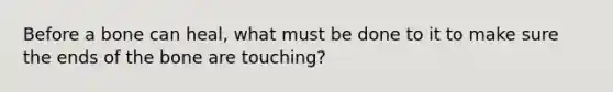 Before a bone can heal, what must be done to it to make sure the ends of the bone are touching?