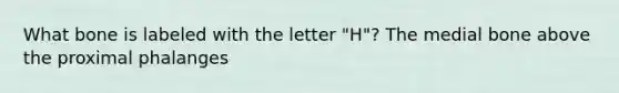 What bone is labeled with the letter "H"? The medial bone above the proximal phalanges