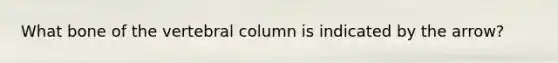 What bone of the <a href='https://www.questionai.com/knowledge/ki4fsP39zf-vertebral-column' class='anchor-knowledge'>vertebral column</a> is indicated by the arrow?