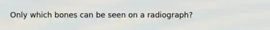Only which bones can be seen on a radiograph?
