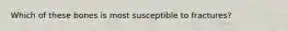 Which of these bones is most susceptible to fractures?