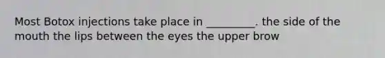 Most Botox injections take place in _________. the side of the mouth the lips between the eyes the upper brow