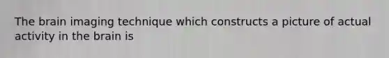 The brain imaging technique which constructs a picture of actual activity in the brain is