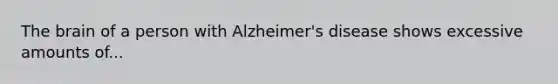 The brain of a person with Alzheimer's disease shows excessive amounts of...