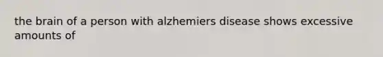 <a href='https://www.questionai.com/knowledge/kLMtJeqKp6-the-brain' class='anchor-knowledge'>the brain</a> of a person with alzhemiers disease shows excessive amounts of