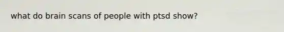 what do brain scans of people with ptsd show?