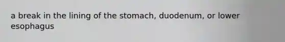 a break in the lining of the stomach, duodenum, or lower esophagus