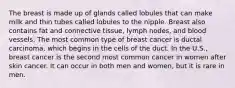 The breast is made up of glands called lobules that can make milk and thin tubes called lobules to the nipple. Breast also contains fat and connective tissue, lymph nodes, and blood vessels. The most common type of breast cancer is ductal carcinoma, which begins in the cells of the duct. In the U.S., breast cancer is the second most common cancer in women after skin cancer. It can occur in both men and women, but it is rare in men.