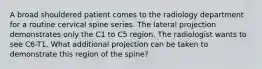 A broad shouldered patient comes to the radiology department for a routine cervical spine series. The lateral projection demonstrates only the C1 to C5 region. The radiologist wants to see C6-T1. What additional projection can be taken to demonstrate this region of the spine?