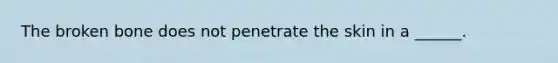 The broken bone does not penetrate the skin in a ______.