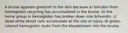 A bruise appears greenish in the skin because a) bilirubin from hemoglobin recycling has accumulated in the bruise. b) the heme group in hemoglobin has broken down into biliverdin. c) dead white blood cells accumulate at the site of injury. d) green-colored hemoglobin leaks from the bloodstream into the bruise.