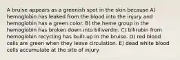 A bruise appears as a greenish spot in the skin because A) hemoglobin has leaked from the blood into the injury and hemoglobin has a green color. B) the heme group in the hemoglobin has broken down into biliverdin. C) bilirubin from hemoglobin recycling has built-up in the bruise. D) red blood cells are green when they leave circulation. E) dead white blood cells accumulate at the site of injury.