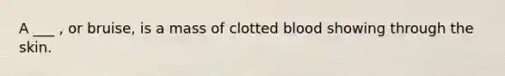 A ___ , or bruise, is a mass of clotted blood showing through the skin.