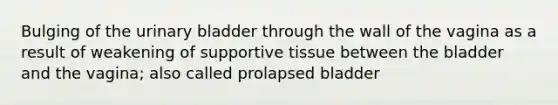 Bulging of the urinary bladder through the wall of the vagina as a result of weakening of supportive tissue between the bladder and the vagina; also called prolapsed bladder