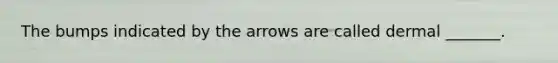The bumps indicated by the arrows are called dermal _______.